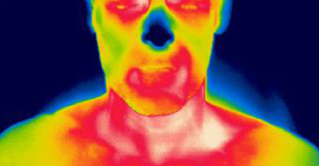 两名BAT阳性受试者和(B)一名BAT阴性受试者在120分钟冷却前后的代表性PET-CT和红外热成像